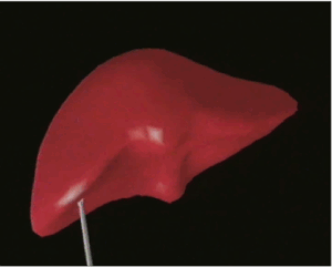 62